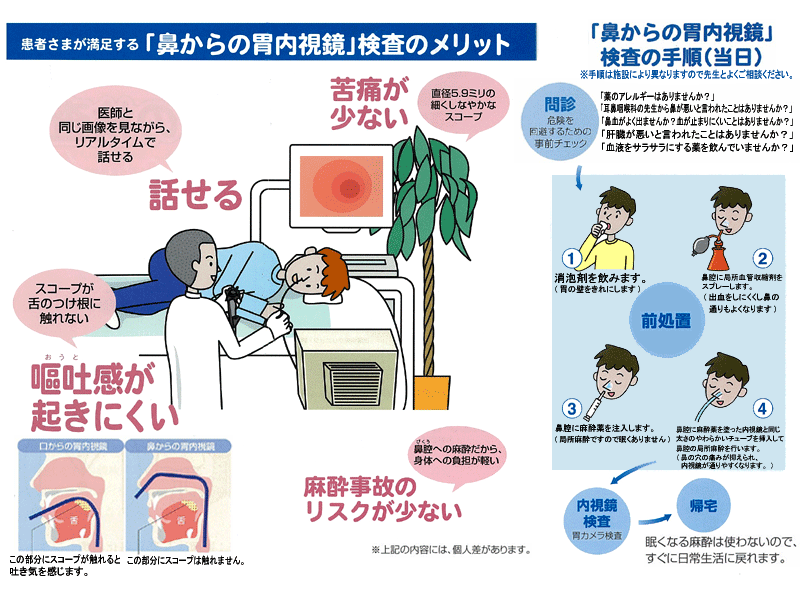 内視鏡の説明の写真